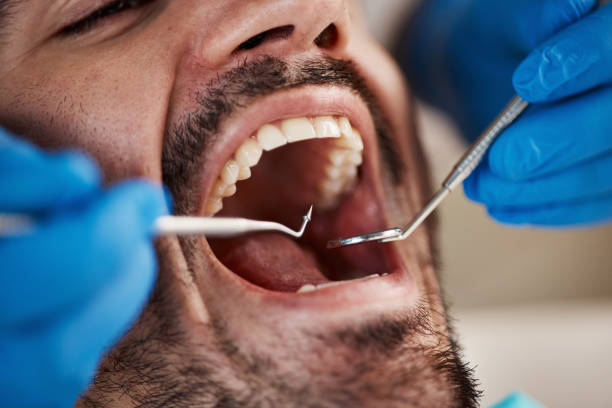 Best Emergency Tooth Extraction in Dallas Center, IA